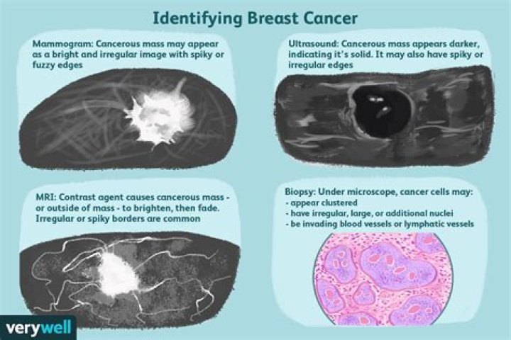 Are cancerous lumps movable or fixed?