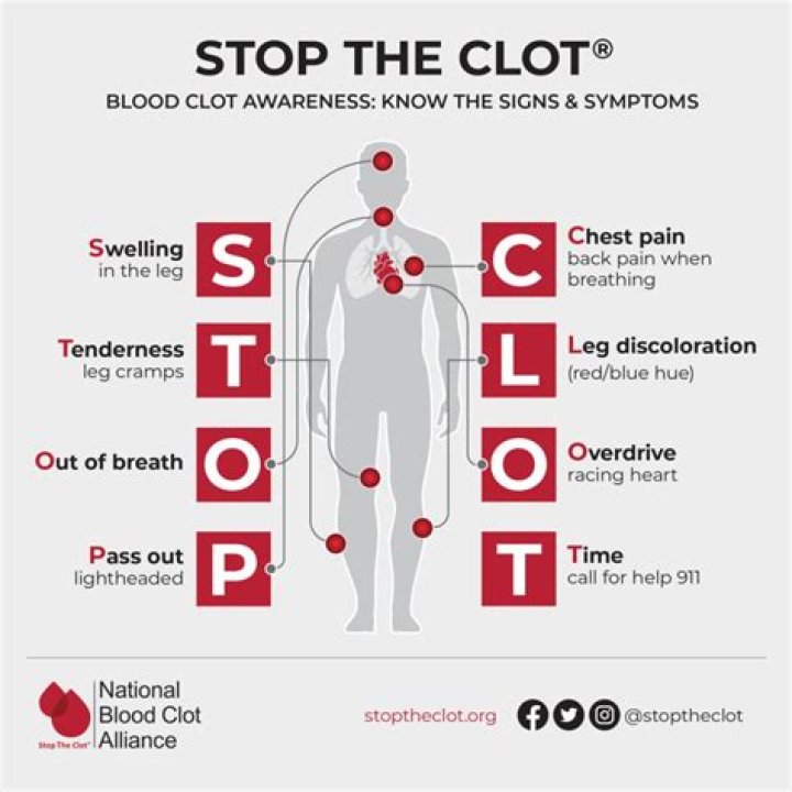 Are there warning signs of blood clots?