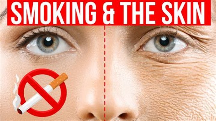 At what age do most smokers get COPD?