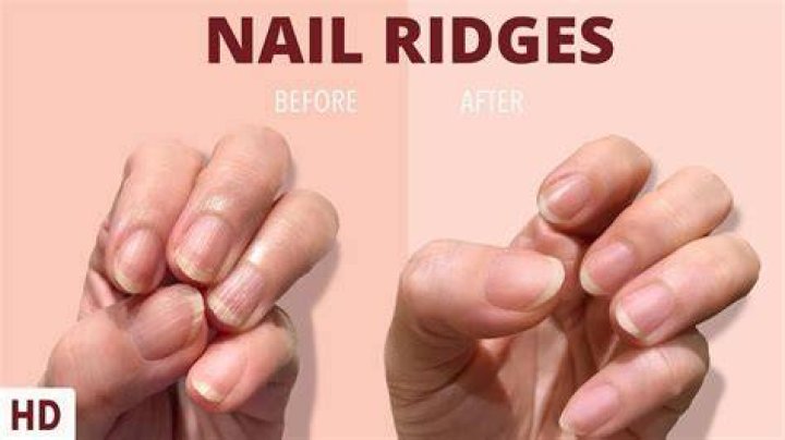 At what age do nails get ridges?