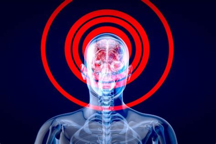 Can a tooth infection affect your brain?