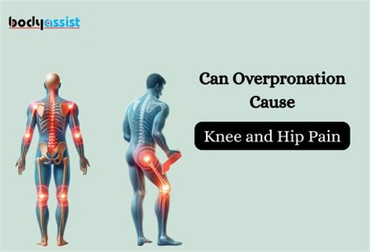 Can AVN of the hip cause knee pain?