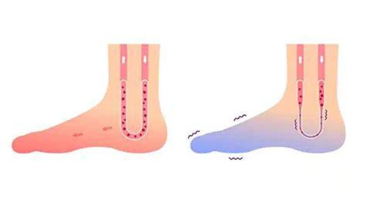 Can lying down too much cause poor circulation?