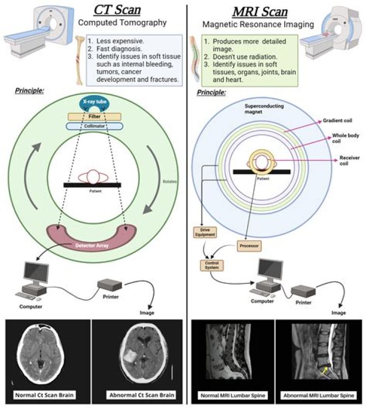 Can scar tissue show up on an MRI?