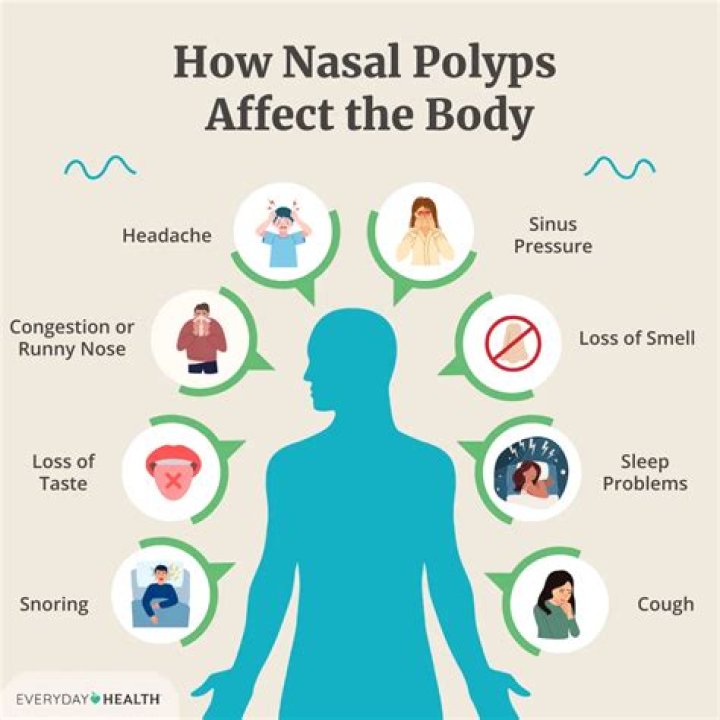 Can vaping cause polyps?