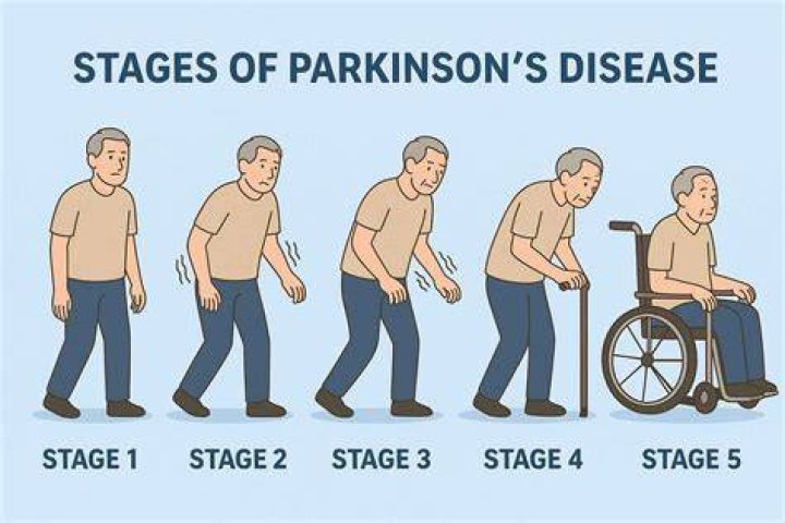 Can you drive with Parkinson's?