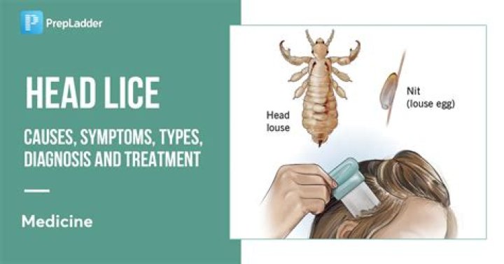 Can you feel lice biting your head?