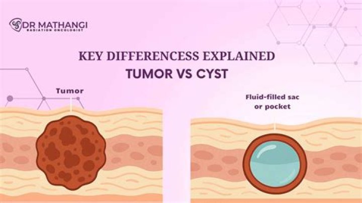 Can you feel the difference between a cyst and a tumor?