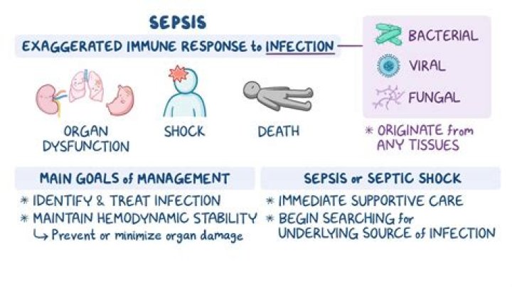 Can you get sepsis without an infection?