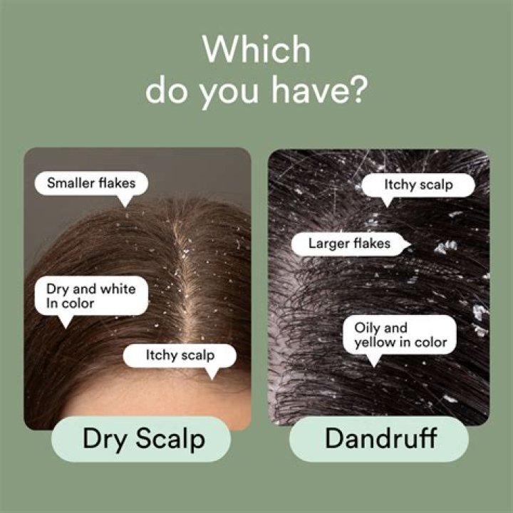 Do lice like wet or dry hair?