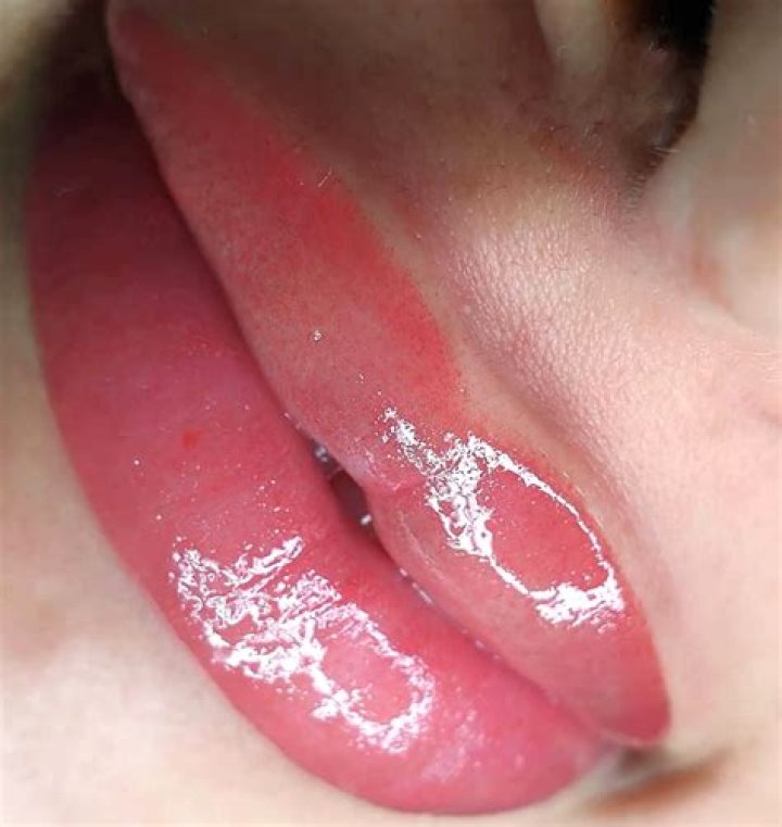 Do lip tattoos get infected easily?