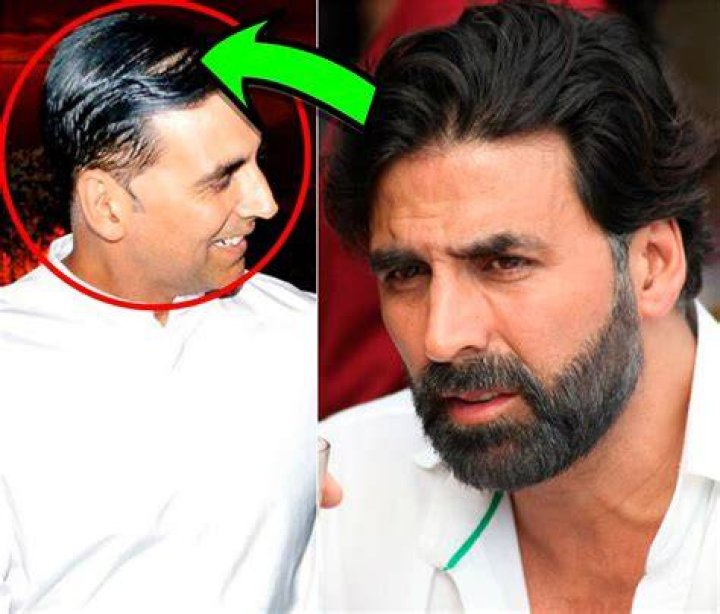 Does Akshay Kumar dye his hair?