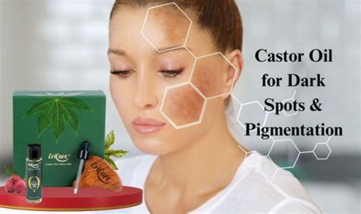 Does castor oil fade dark spots?