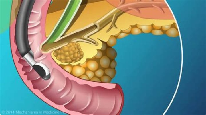 Does endoscopy check pancreas?