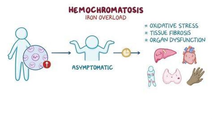 Does hemochromatosis make you gain weight?