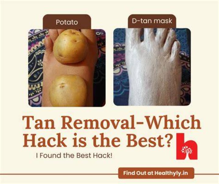 Does potato remove tan?