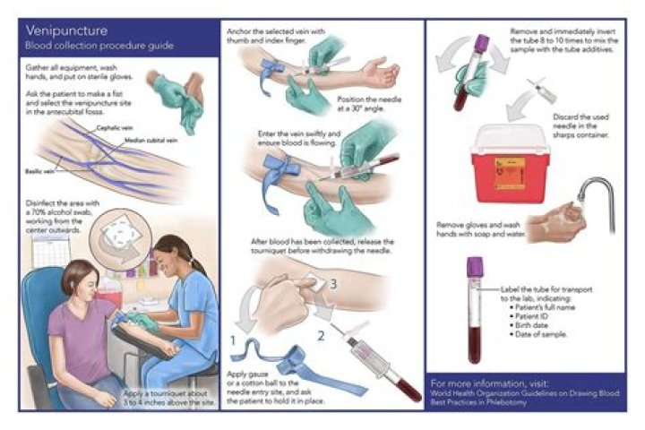 Does therapeutic phlebotomy make you tired?