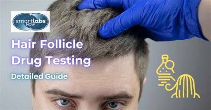 Does Walmart have hair follicle test?