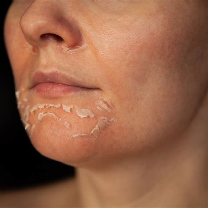 How can I grow new skin on my face?