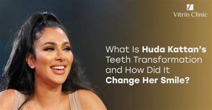 How did teeth end?