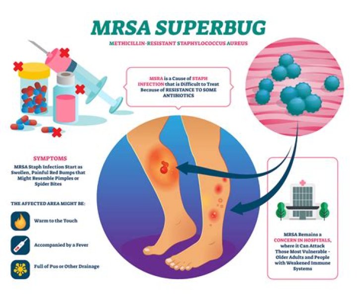 How do I know if MRSA has spread to organs?