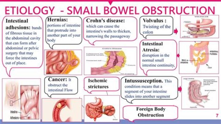 How do they remove a bowel obstruction?