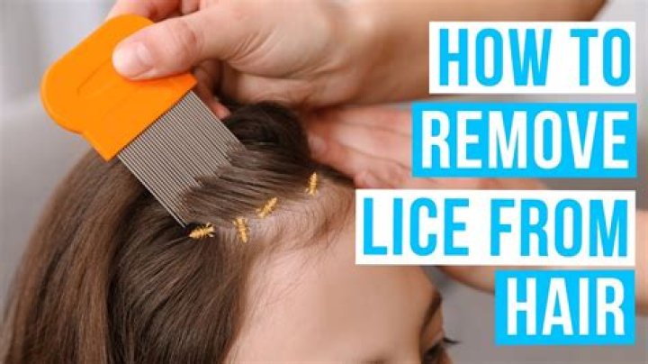 How do you get rid of lice fast?