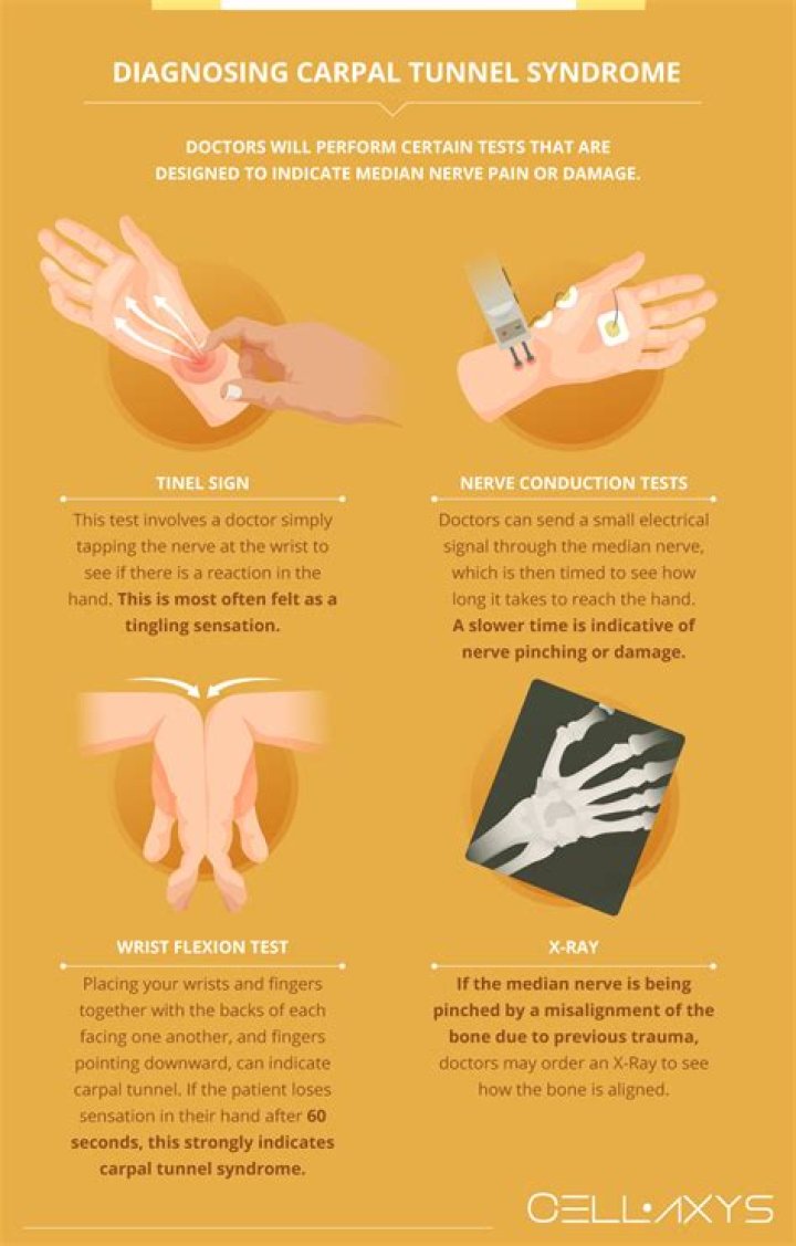 How does EMG diagnose carpal tunnel?