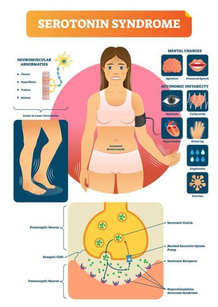 How long can you have serotonin syndrome?