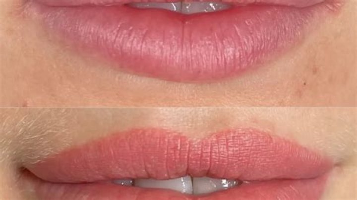 How long do lips stay swollen after lip blushing?
