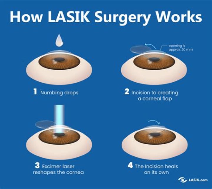 How many days rest is required after laser eye surgery?