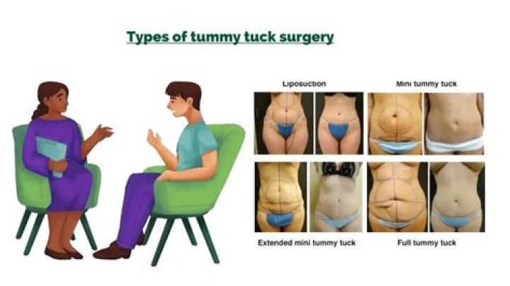 How many lbs Do you lose after a tummy tuck?