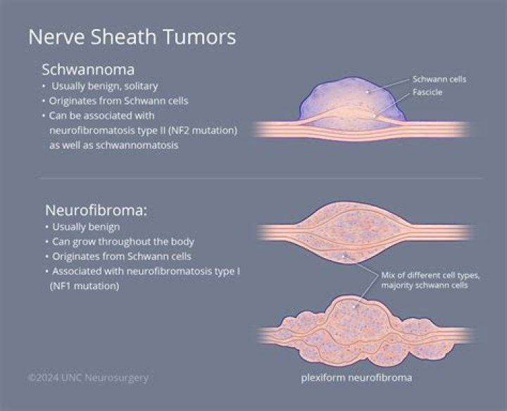 How quickly do neurofibromas grow?