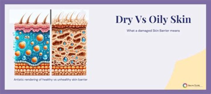 Is it better to have oily or dry skin?
