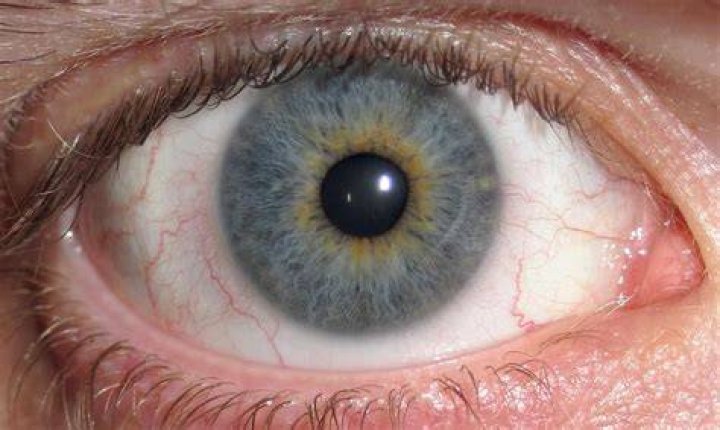 Is it rare to have gray eyes?