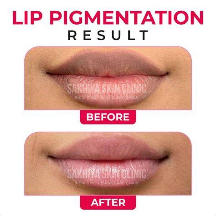 Is lip color genetic?
