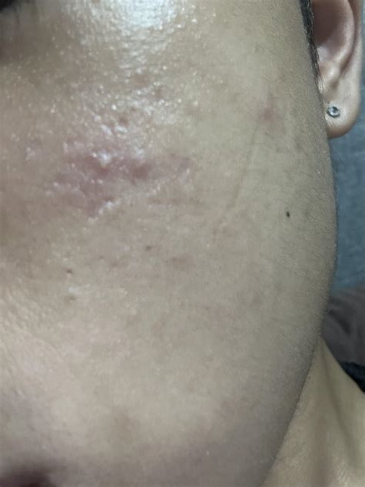 Is my face dry or oily?