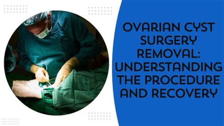 Is ovarian cyst removal a major surgery?