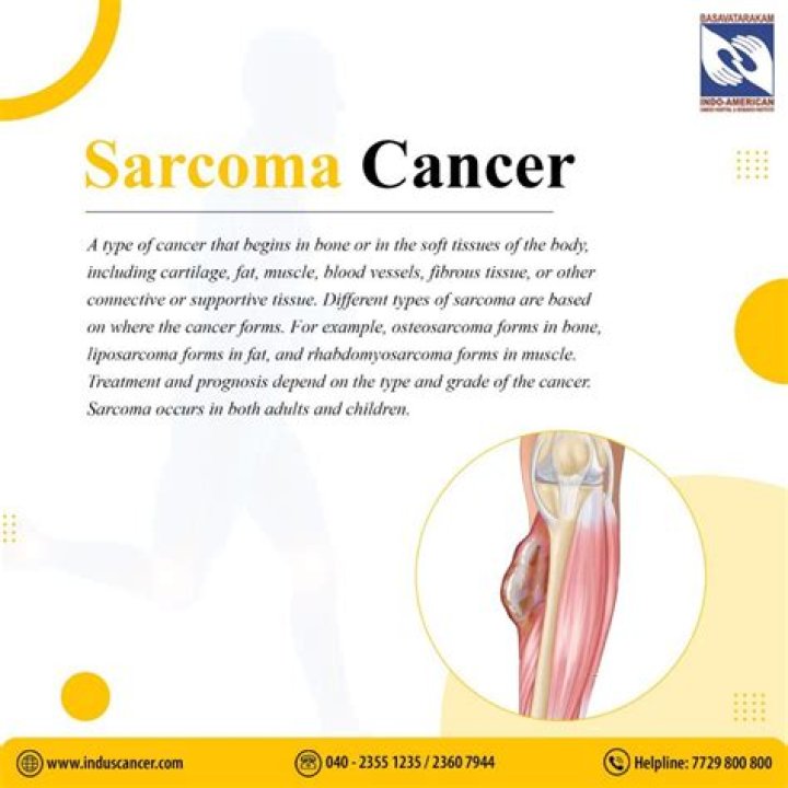 Is sarcoma fatal?