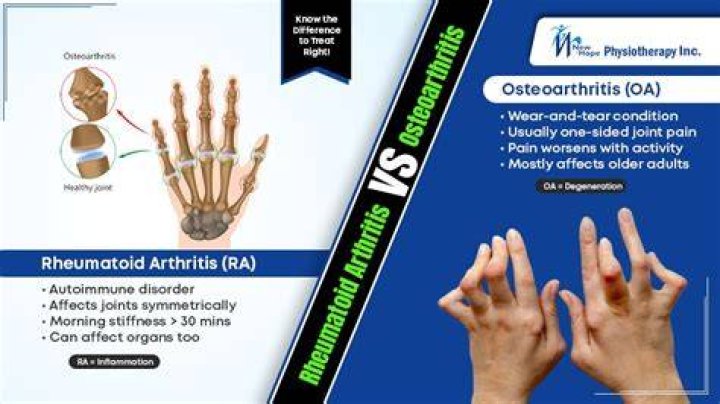 Is there a difference between arthritis and osteoarthritis?