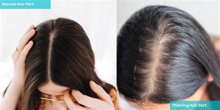 Should I color my hair if it is thinning?