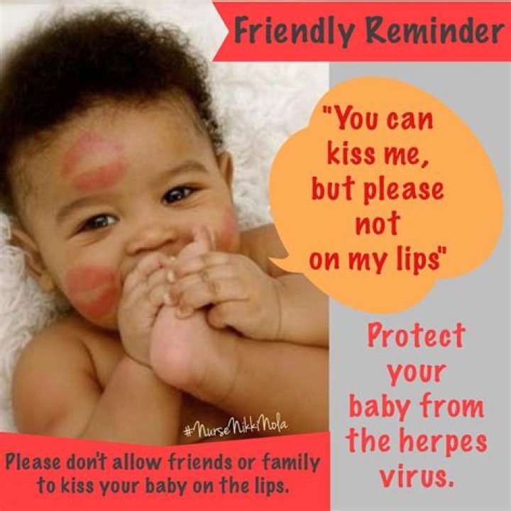 Should I not kiss my baby if I have a cold?