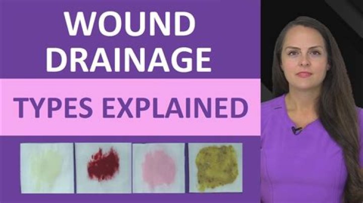What color is Serosanguineous drainage?