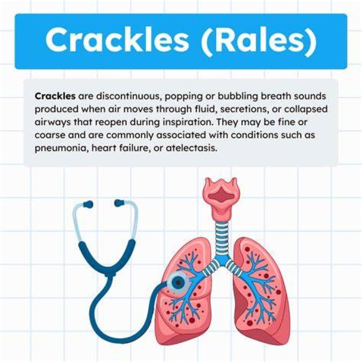 What does a crackle on the lung mean?