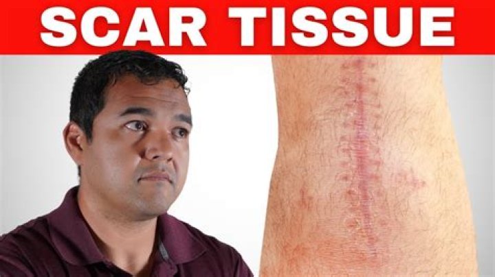 What does painful scar tissue feel like?