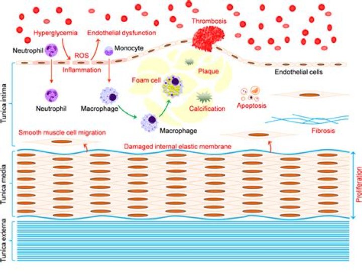 What is a macrovascular disease?