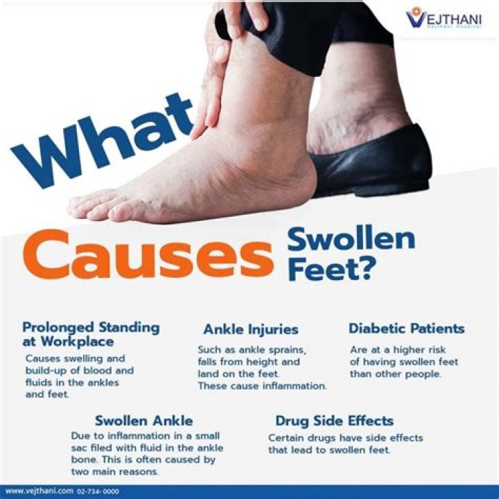 What is the main cause of swollen feet?