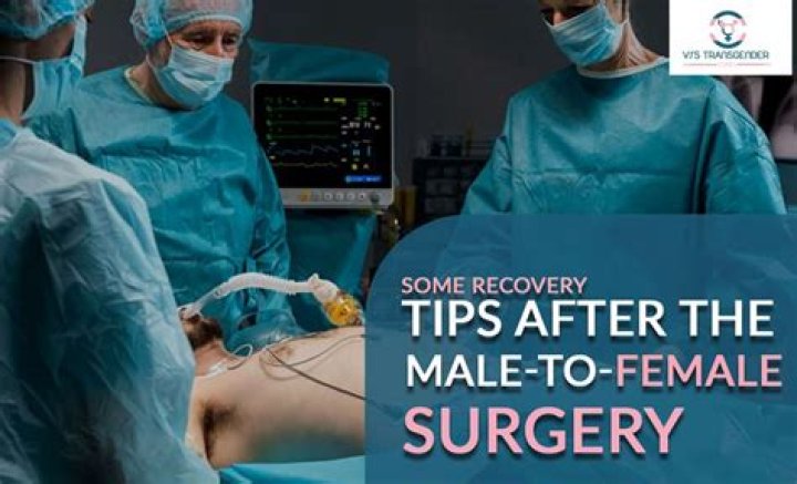What is top surgery male to female?