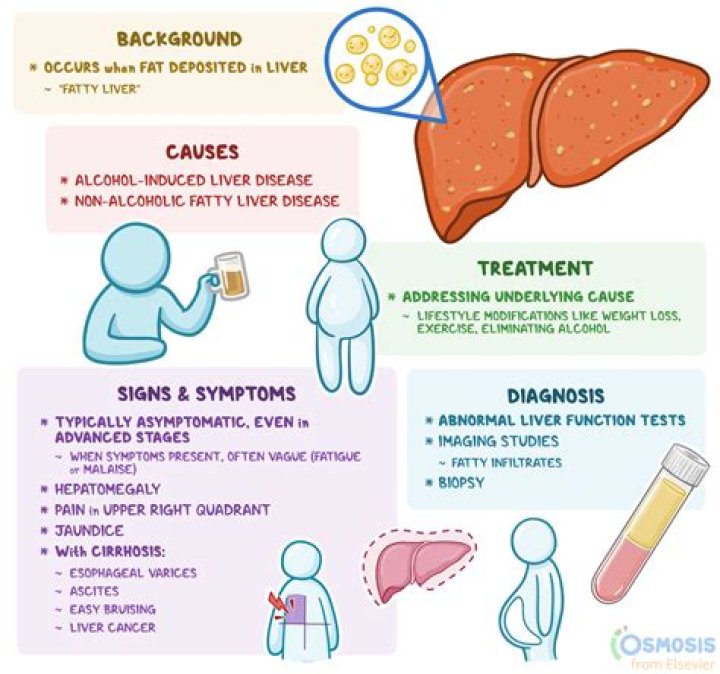 What liver disease causes high ferritin levels?