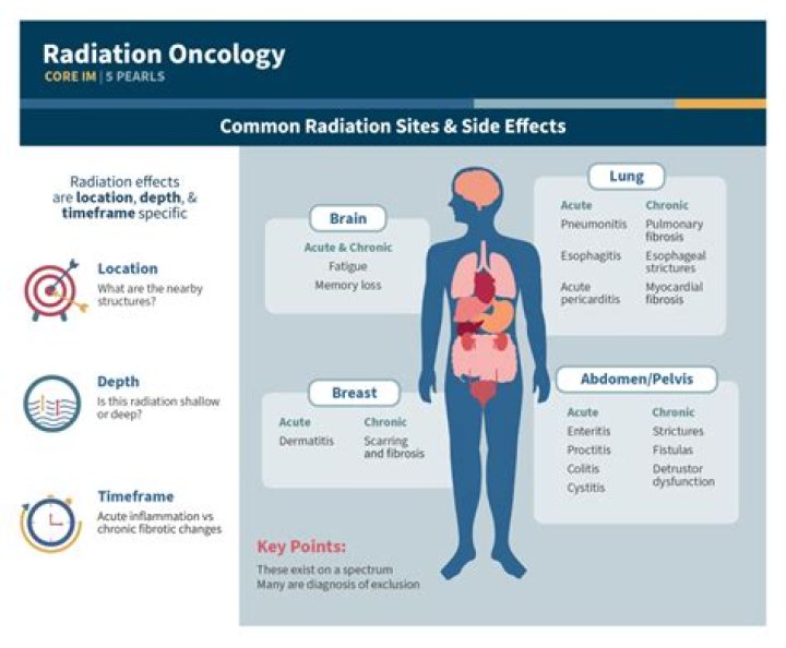 What organs are most sensitive to radiation?